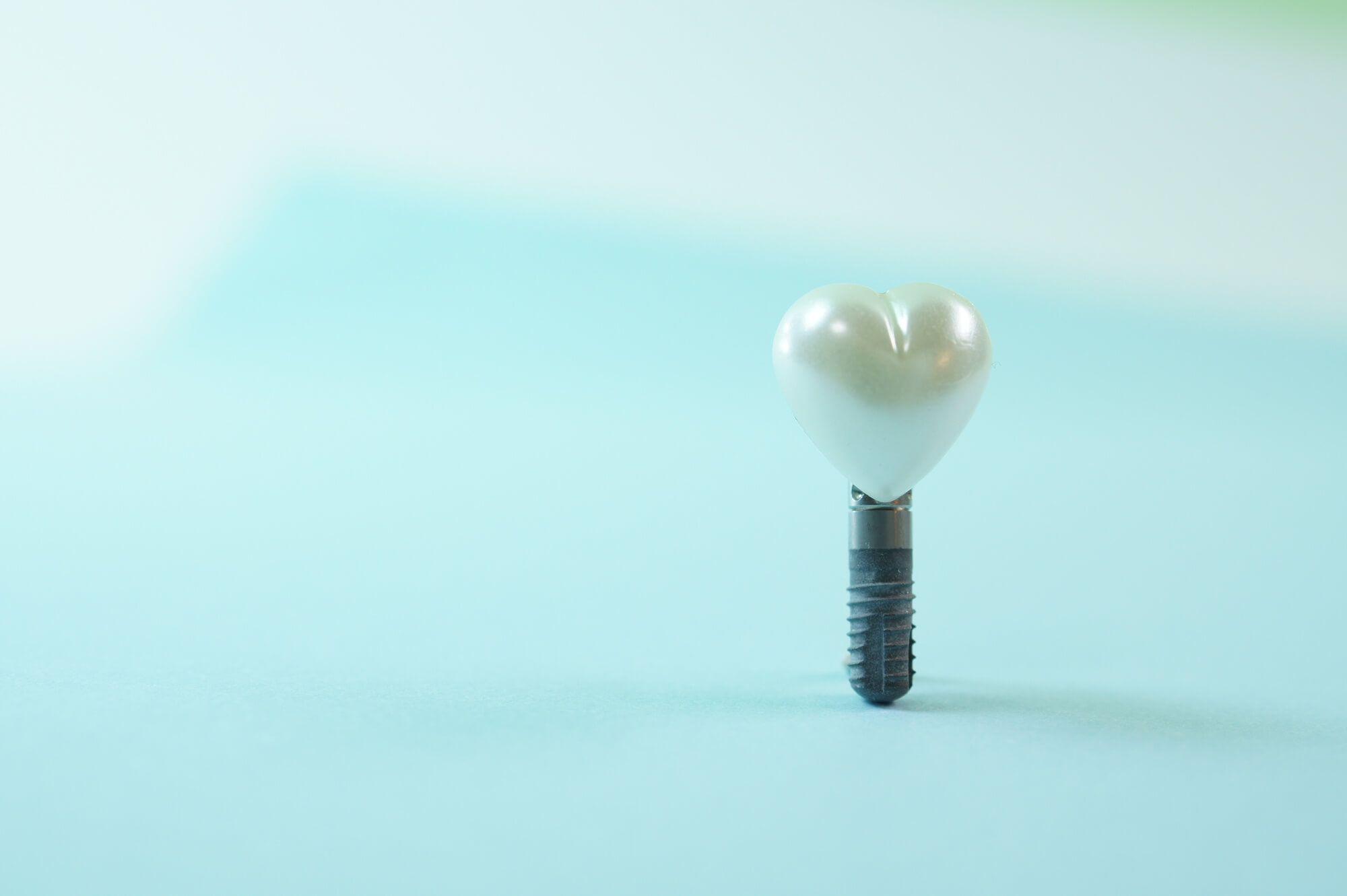 インプラント歯科が狙うべきSEOキーワード